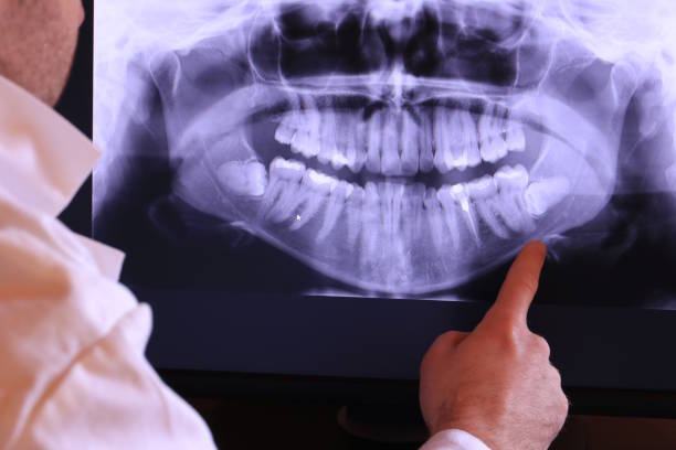 Best Dentist for Severe Toothache  in Bonny Doon, CA
