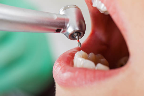 Best Emergency Pediatric Dentist  in Bonny Doon, CA